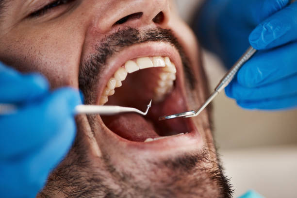 Best Broken Tooth Emergency  in Roma, TX