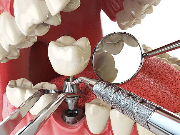 Best Urgent Tooth Repair  in Roma, TX